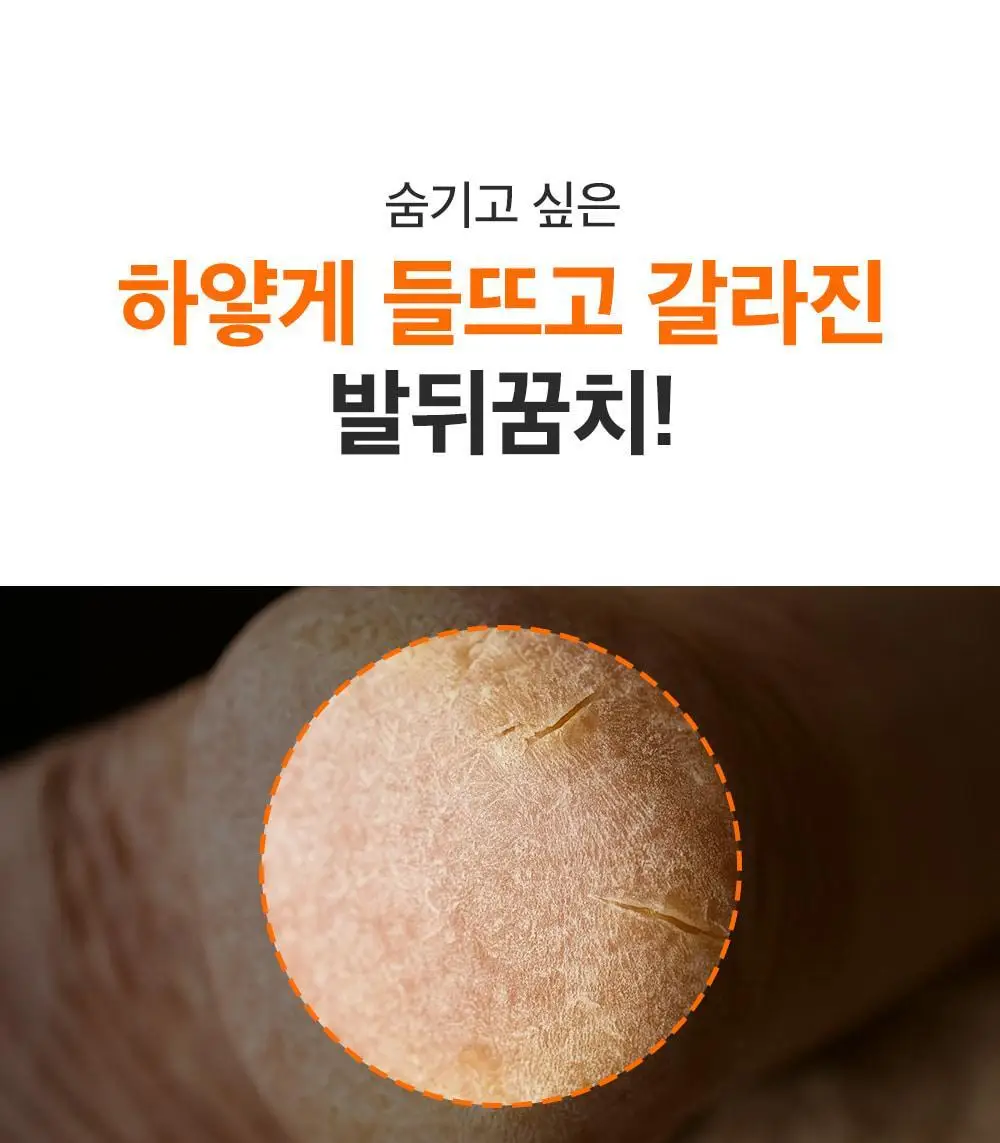 [데일리풋케어/맨들맨들아기발] 성분에디터 시어버터 베이비 풋 스틱 20g 2종 택 1 상세페이지 50